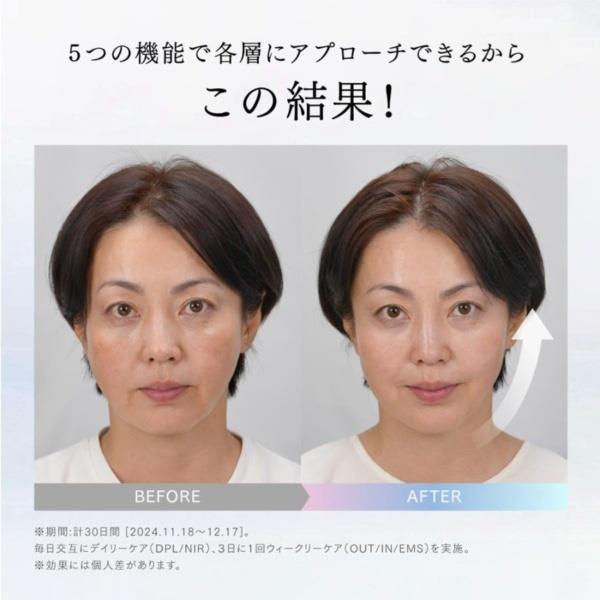 MYTREX マルチヘッド美顔器 MiRAY ONE ブラック MT-MRO-24B | ノジマ