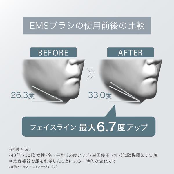 大陸モモンガ フェイス＆ボディ全身対応型 美容器 アイエスト3000EMS DPC スキンアイロン